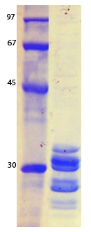SARS Coronavirus Envelope (HSZ-Cc) Recombinant Protein