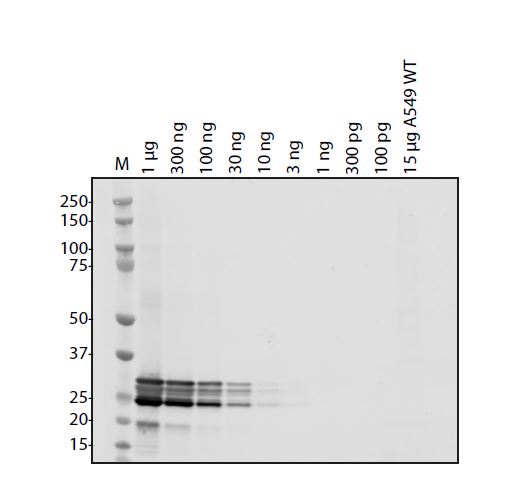 SARS Coronavirus (HSZ-Cc) Envelope Antibody