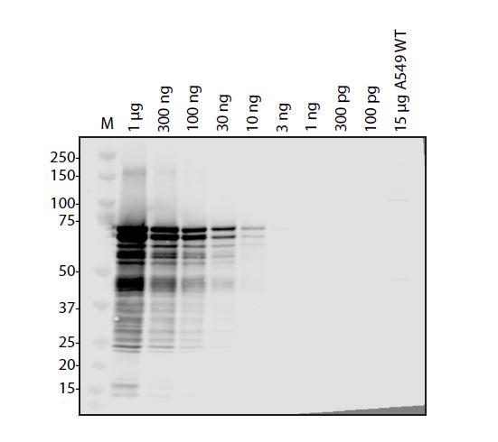 SARS Coronavirus (HSZ-Cc) Nucleocapsid Antibody