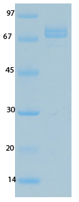 SARS Coronavirus Nucleocapsid (HSZ-Cc) Recombinant Protein
