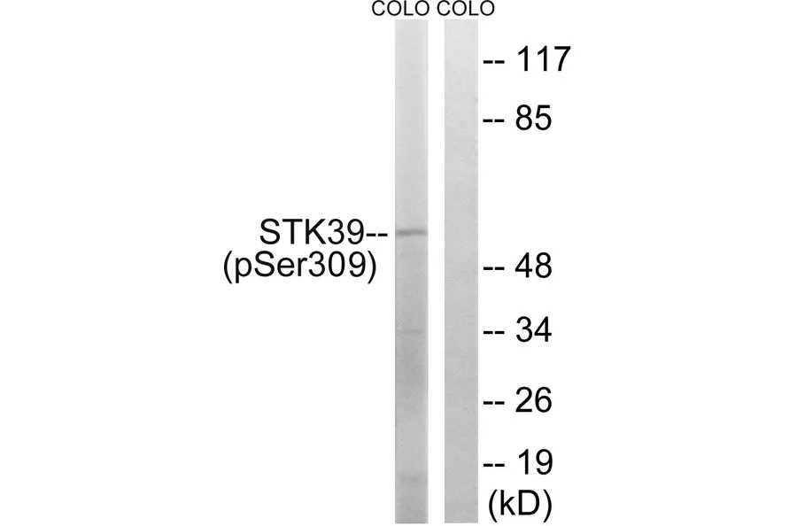 STK39 (phospho Ser309) Antibody