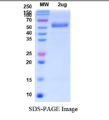 SARS-CoV-2 (COVID-19) Omicron varient (B.1.1.529) Spike RBD Recombinant Protein