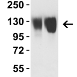 <strong>Figure 3 WB Validation of Omicron Variant Spike S1 Protein with SARS-CoV-2 Spike Antibodies </strong><br>Loading: 30 ng of SARS-CoV-2 spike S1 proteins, including WT and Omicron variant (B.1.1.529).Detection Antibodies: SARS-CoV-2 spike S1 antibody, 9083, 1 μg/mL, incubated at RT for 1 hr.Secondary Antibodies: Goat anti-rabbit HRP at 1:20,000, incubate at RT for 1 hr.SARS-CoV-2 Omicron Variant S1 protein (95-129) and WT spike S1 protein (10-300), were both detected by spike S1 antibody (9083). </strong>