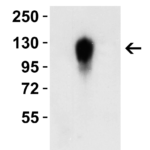 <strong>Figure 4 WB Validation of of Omicron Variant Spike Antibodies with SARS-CoV-2 Omicron Variant Spike S1 Protein </strong><br>Loading: 30 ng of SARS-CoV-2 spike S1 proteins, including WT, Delta variant (B.1.617.2) and Omicron variant (B.1.1.529).Detection Antibodies: SARS-CoV-2 Omicron Variant Spike antibody, 9793, 2 μg/mL, incubated at RT for 1 hr.Secondary Antibodies: Goat anti-rabbit HRP at 1:20,000, incubated at RT for 1 hr.<strong>SARS-CoV-2 Omicron Variant Spike antibody (9793) specifically detects Omicron variant spike S1 protein (95-129), but not spike S1 protein of WT (10-300) and Delta (95-127). </strong>