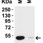 <strong>Figure 2 Western Blot Validation in Mouse Tissues </strong><br>Loading: 15 μg of lysates per lane.Antibodies: TMPRSS2 9569, 2 μg/mL, 1h incubation at RT in 5% NFDM/TBST.Secondary: Goat anti-rabbit IgG HRP conjugate at 1:10,000 dilution.