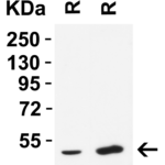 <strong>Figure 3 Western Blot Validation in Rat Tissues</strong><br>Loading: 15 μg of lysates per lane.Antibodies: TMPRSS2 9569, 2 μg/mL, 1h incubation at RT in 5% NFDM/TBST.Secondary: Goat anti-rabbit IgG HRP conjugate at 1:10,000 dilution.