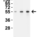 <strong>Figure 1 WB Validation  in Human Testis </strong><br>Loading: 15 μg of lysate Antibodies:  TMPRSS2 9569, 1 h incubation at RT in 5% NFDM/TBST. Secondary: Goat Anti-Rabbit IgG HRP conjugate at 1:10,000 dilution.Lane 1: 1 μg/mL Lane 2: 2 μg/mL Lane 3: 4 μg/mL