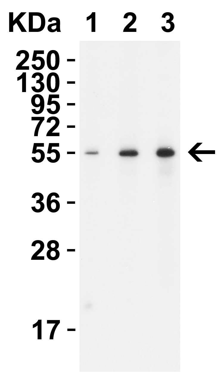 TMPRSS2 (CT) Antibody