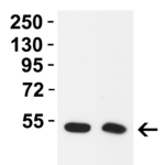<strong>Figure 2 Western Blot Validation in Mouse Tissues </strong><br>Loading: 15 μg of lysates per lane.Antibodies: TMPRSS2 9571, 2 μg/mL, 1h incubation at RT in 5% NFDM/TBST.Secondary: Goat anti-rabbit IgG HRP conjugate at 1:10,000 dilution.