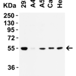 <strong>Figure 1 WB Validation  in Human Cell Lines </strong><br>Loading: 15 μg of lysate Antibodies:  TMPRSS2 9571, 2 μg/mL , 1 h incubation at RT in 5% NFDM/TBST. Secondary: Goat Anti-Rabbit IgG HRP conjugate at 1:10,000 dilution.