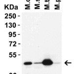 <strong>Figure 1 Western Blot Validation In Mouse Tissues </strong><br>Loading: 15 μg of lysates per lane. Antibodies: IRGB10 9515, 2 μg/mL, 1h incubation at RT in 5% NFDM/TBST. Secondary: Goat anti-rabbit IgG HRP conjugate at 1:10,000 dilution.