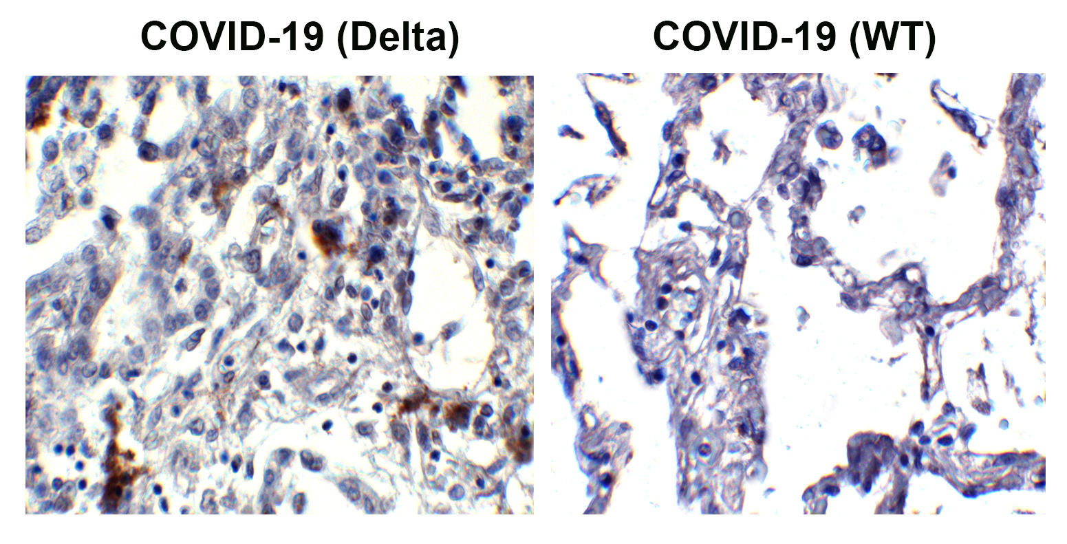 SARS-CoV-2 (COVID-19) Spike P681R Antibody [5H4C5] (Delta Variant)