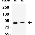 <strong>Figure 2 Western Blot Validation in Mouse Tissues </strong><br>Loading: 15 μg of lysates per lane.  Antibodies: IFI16 9641, 2 μg/mL, 1h incubation at RT in 5% NFDM/TBST.  Secondary: Goat anti-rabbit IgG HRP conjugate at 1:10,000 dilution.