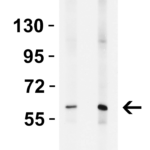 <strong>Figure 1. WB Validation in Human Lung </strong><br>Loading: 15 μg of lysate per lane.     Antibodies:  ZC3H12A 9547, 1 h incubation at RT in 5% NFDM/TBST.     Secondary: Goat Anti-Rabbit IgG HRP conjugate at 1:10,000 dilution.  Lane 1: 2 μg/mL   Lane 2: 4 μg/mL
