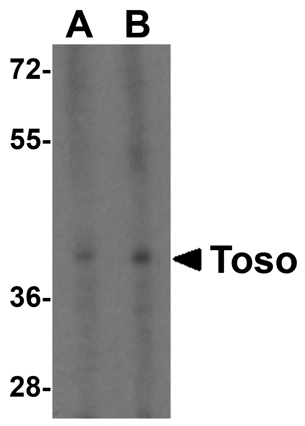 Toso Antibody