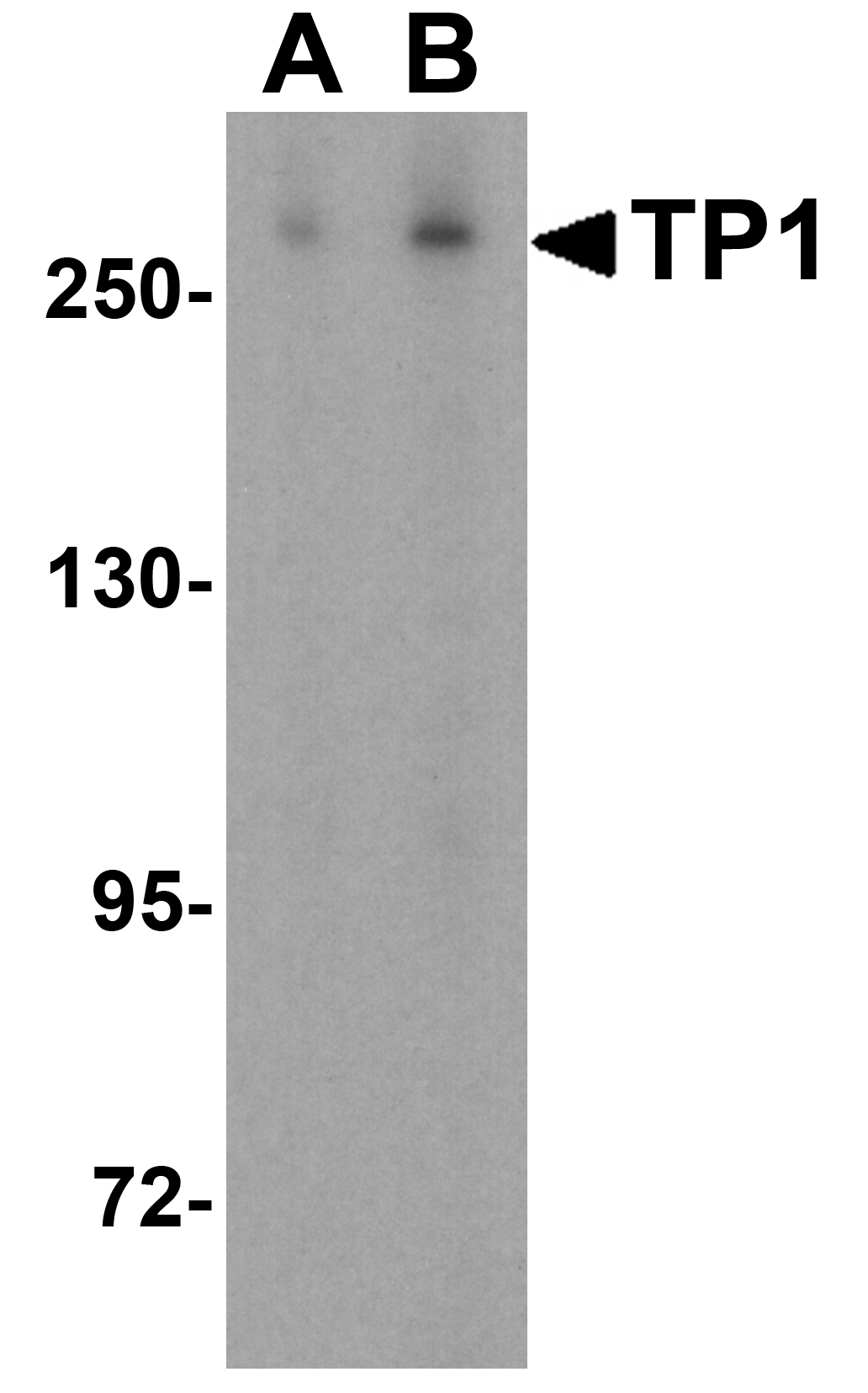 TP1 Antibody