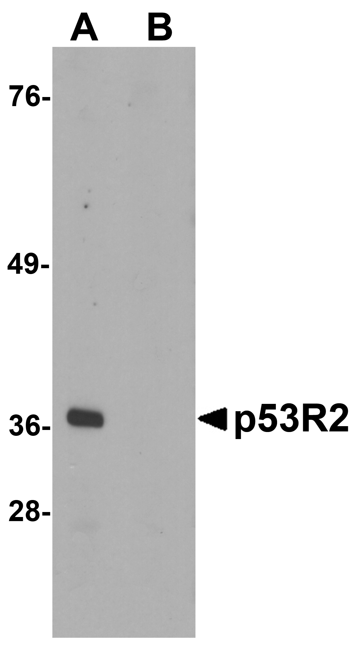 p53R2 Antibody