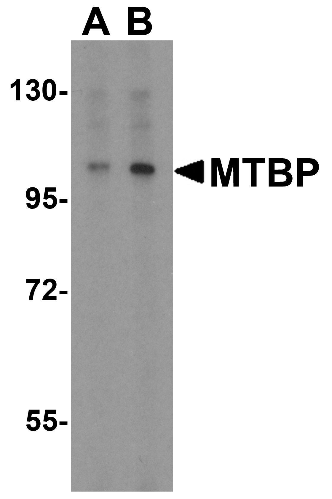 MTBP Antibody