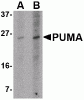 PUMA Antibody [10D4G7]