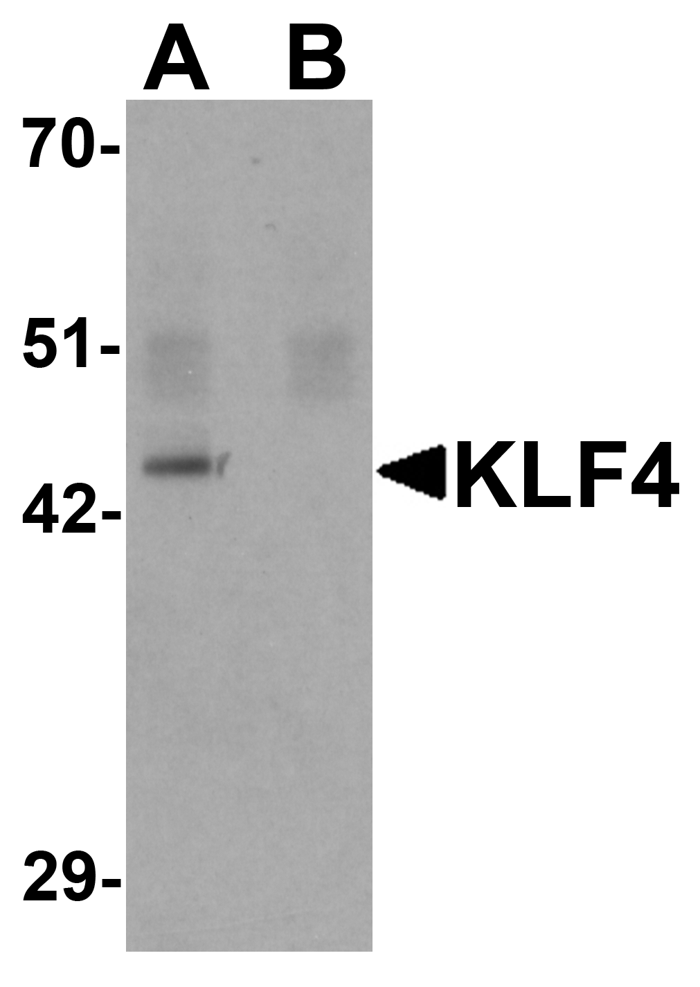 KLF4 Antibody [4G6E11]
