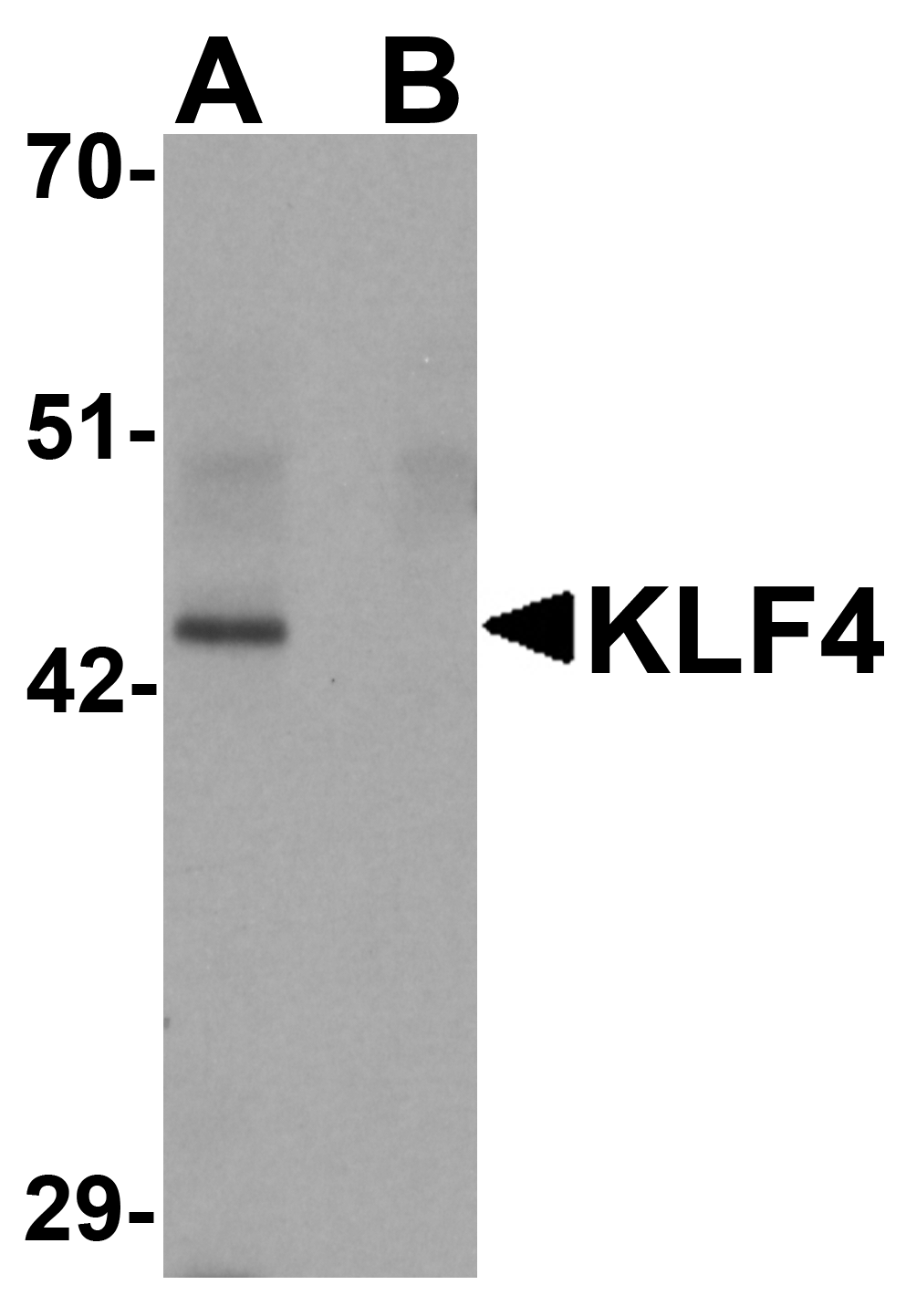 KLF4 Antibody [4E5C3]