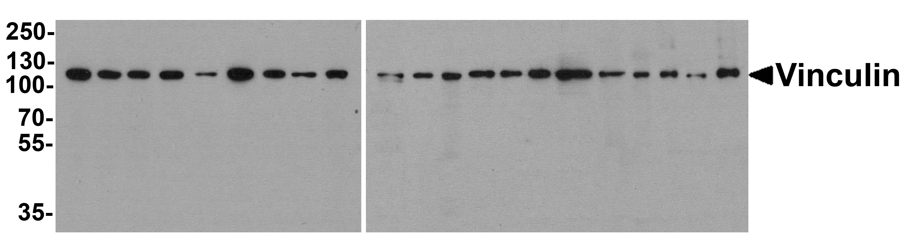 Vinculin Antibody [8B5]