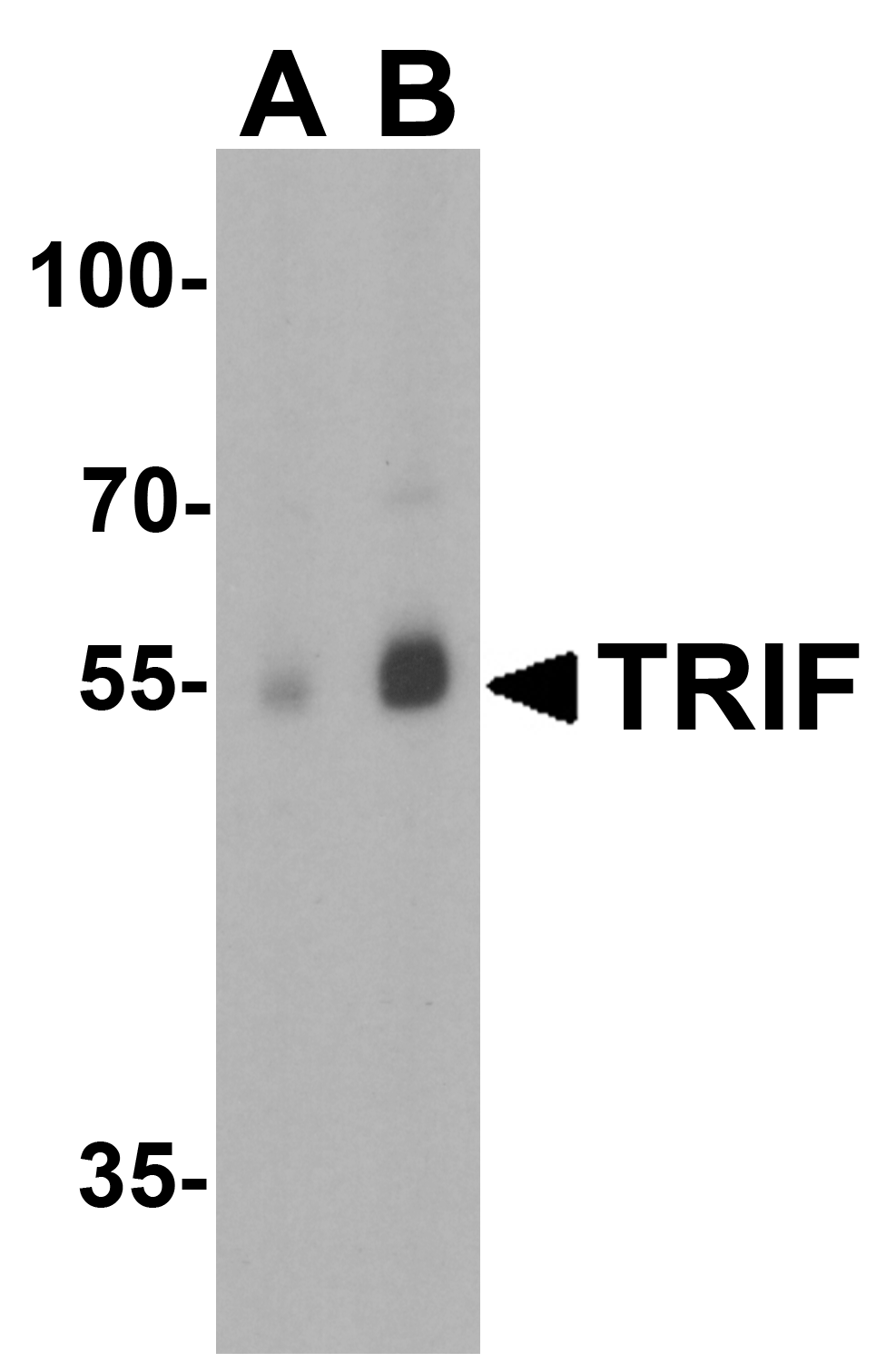 TRIF Antibody
