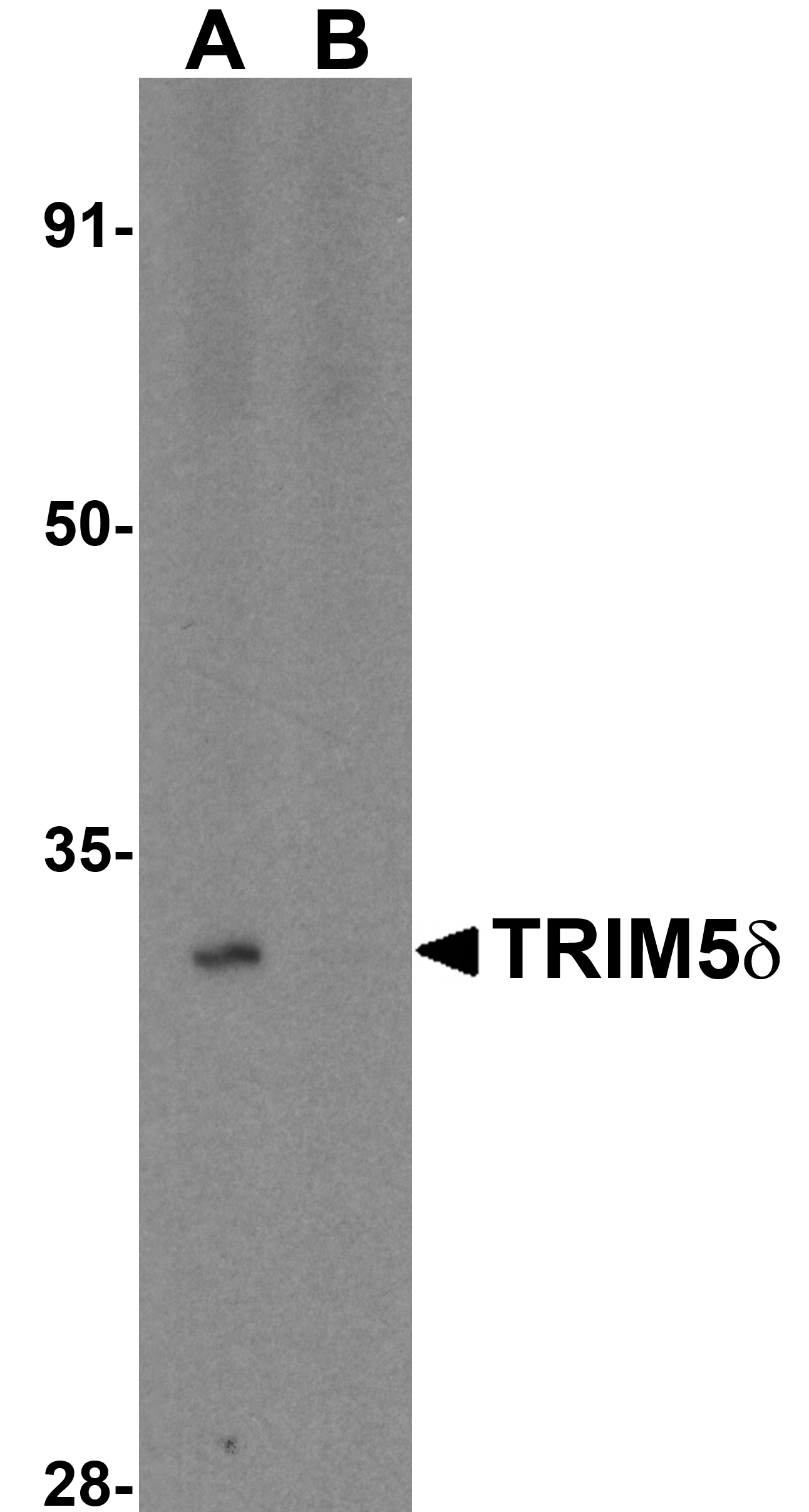 TRIM5 delta Antibody