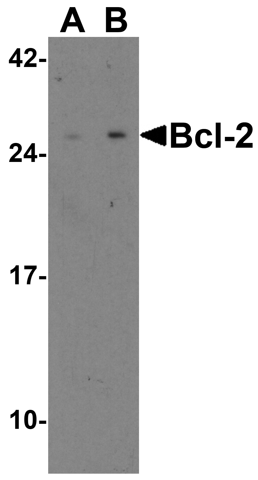 Bcl-2 Antibody