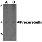 Western blot analysis of precerebellin in mouse cerebellum lysate with precerebellin antibody at (A) 2 and (B) 4 μg/mL.