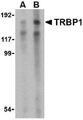 TRBP1 Antibody