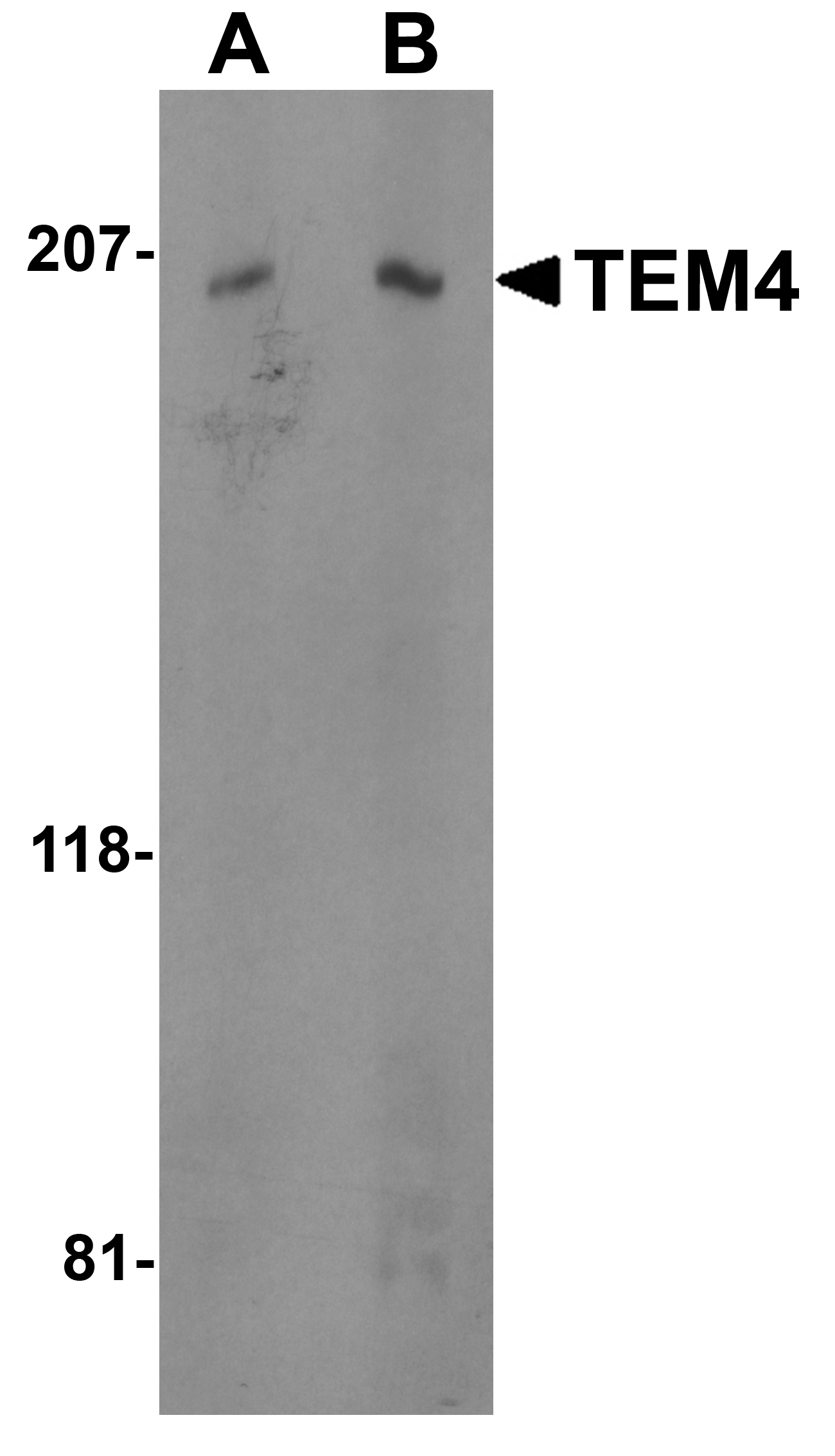 TEM4 Antibody