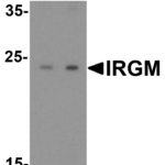 Western blot analysis of IRGM in human brain lysate with IRGM antibody at (A) 1 and (B) 2 μg/mL.