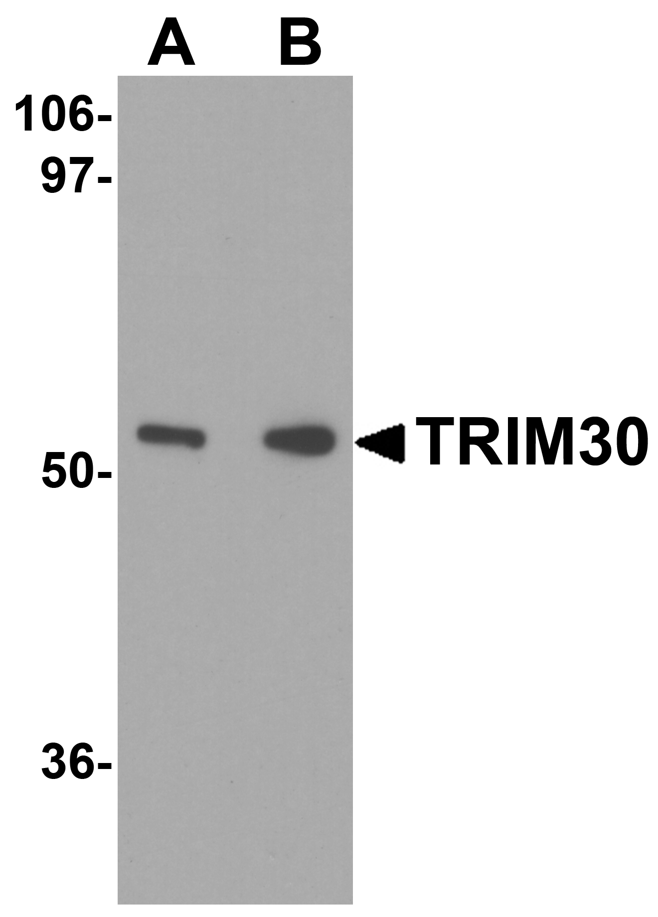 TRIM30 Antibody