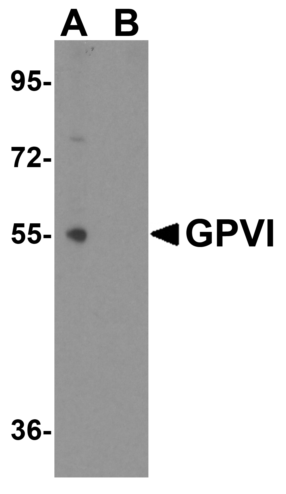 GPVI Antibody