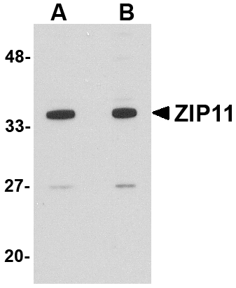 ZIP11 Antibody