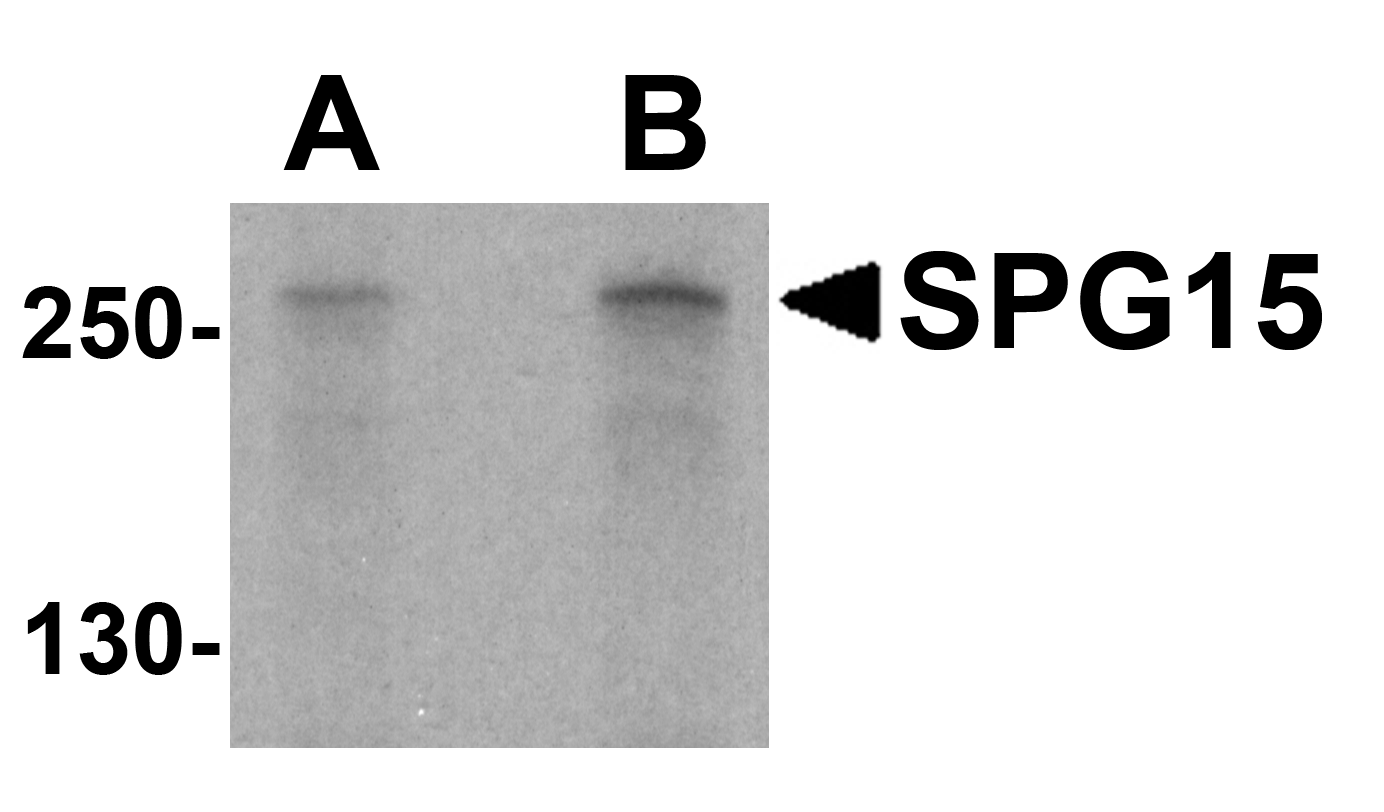 SPG15 Antibody