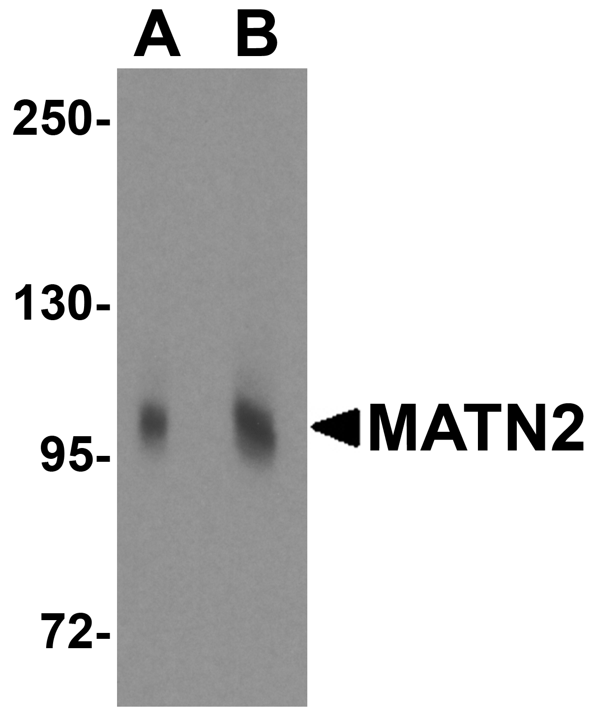 MATN2 Antibody