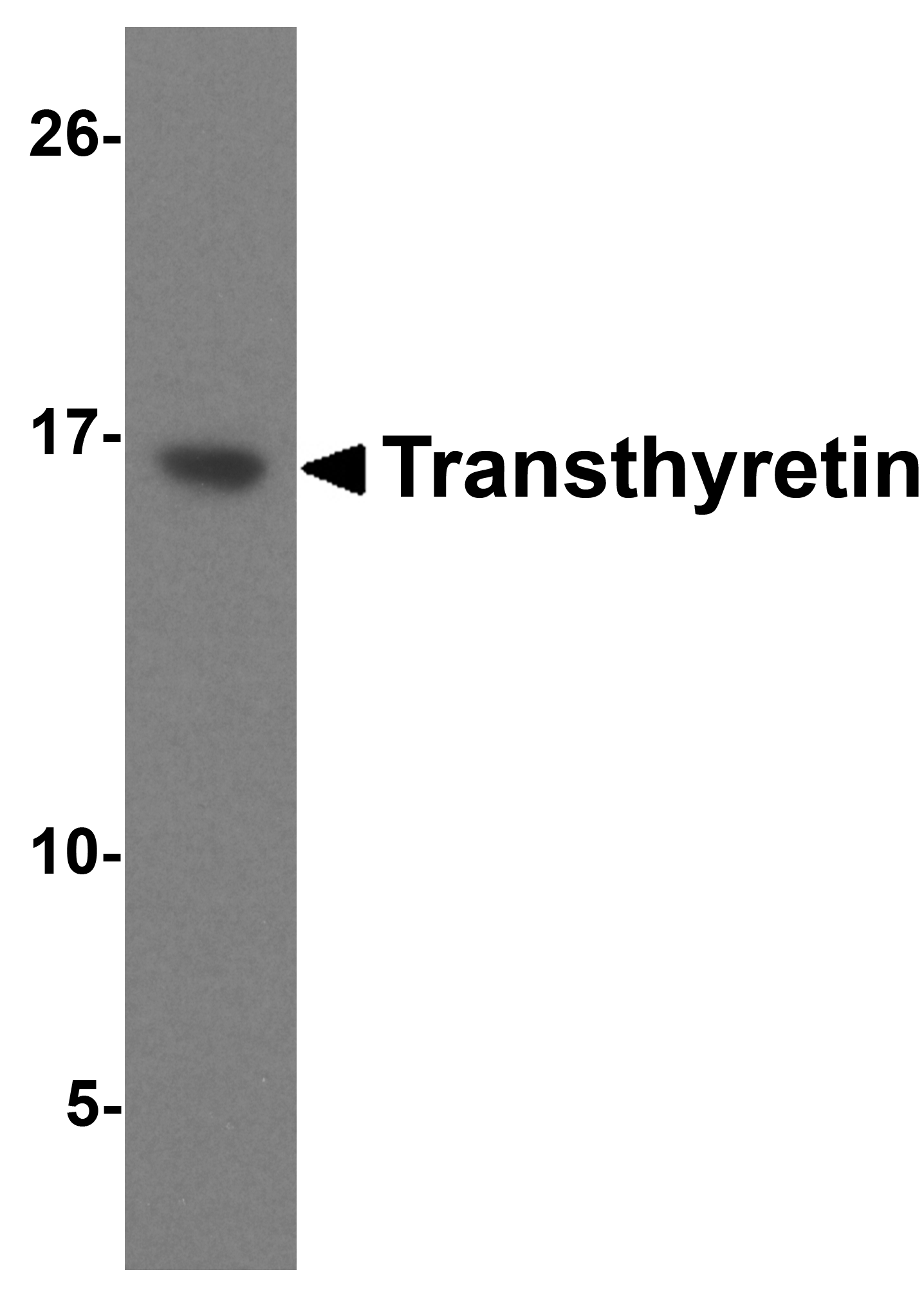 Transthyretin Antibody