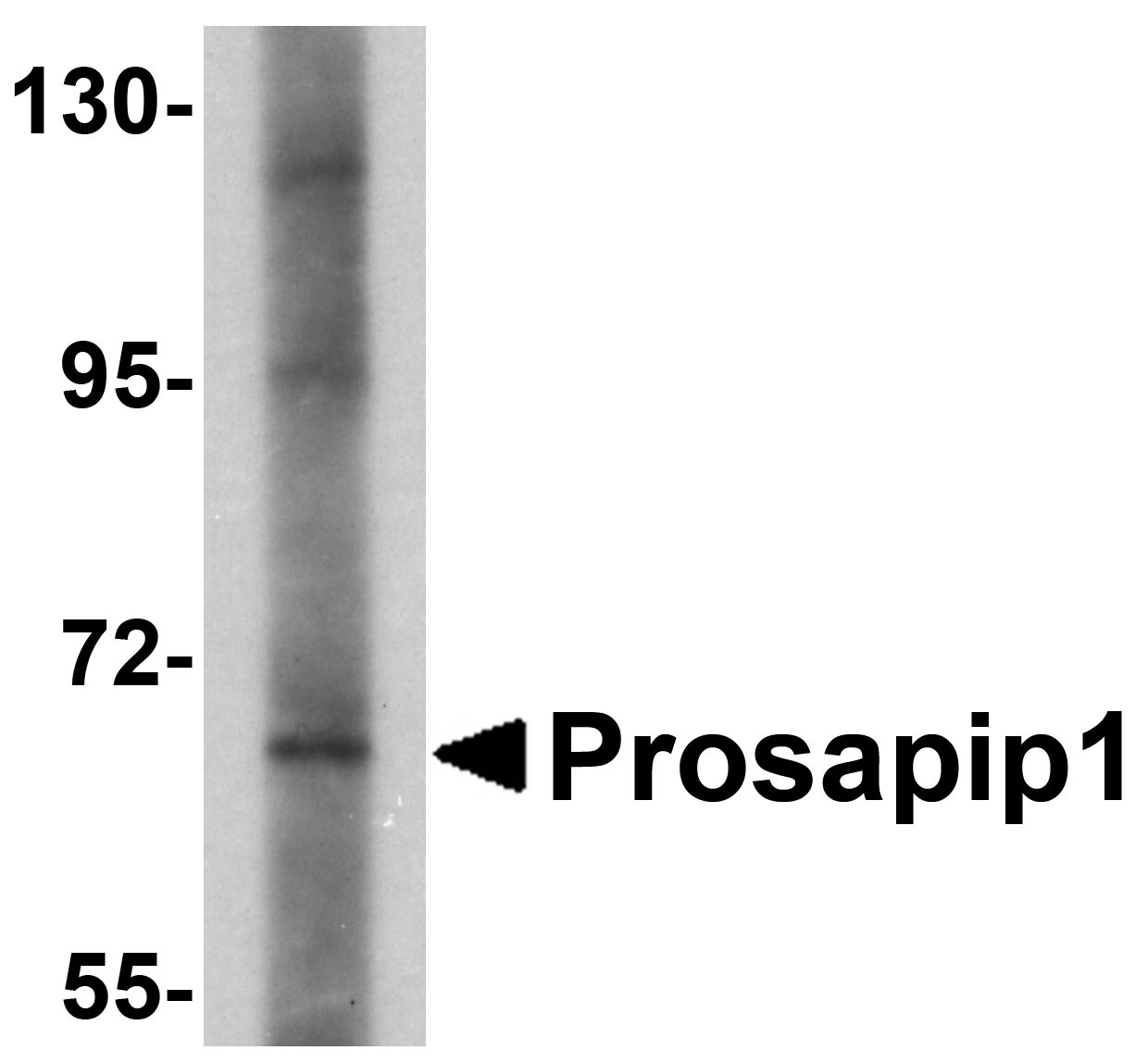 Prosapip1 Antibody