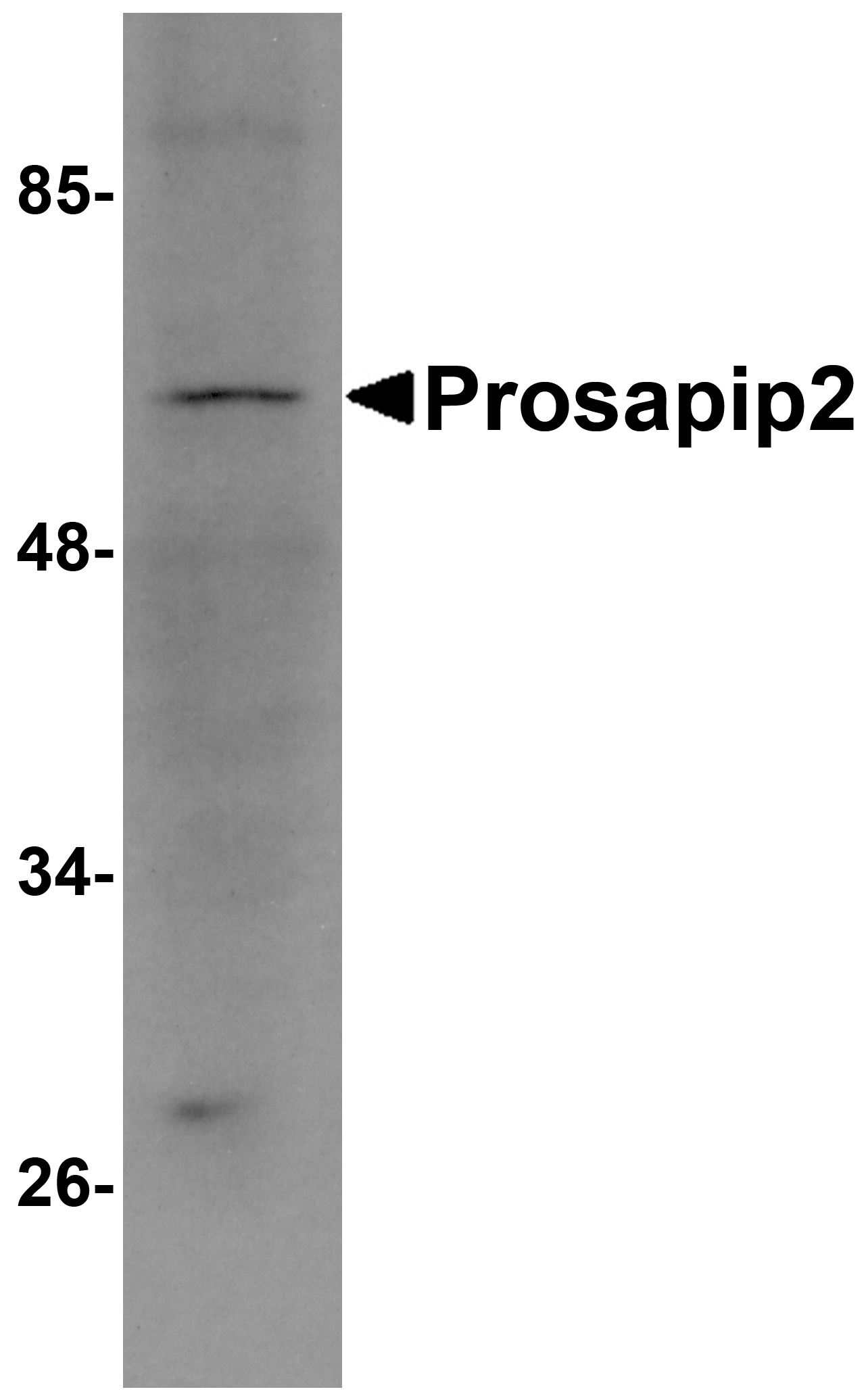 Prosapip2 Antibody