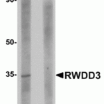 Western blot analysis of RWDD3 in rat kidney tissue lysate with RWDD3 antibody at 1 μg/mL in (A) the absence and (B) the presence of blocking peptide.