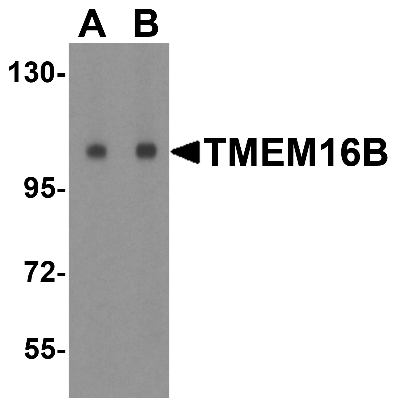 TMEM16B Antibody