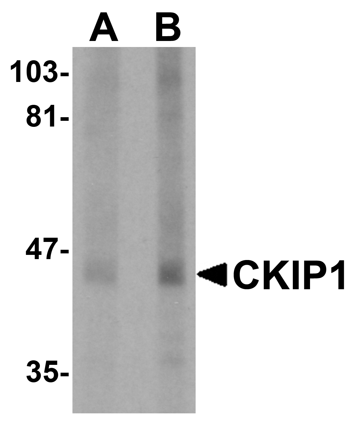 CKIP1 Antibody