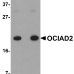 Western blot analysis of OCIAD2 in A549 cell lysate with OCIAD2 antibody at (A) 0.5 and (B) 1 μg/mL.
