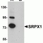 Western blot analysis of SRPX1 in SK-N-SH cell lysate with SRPX1 antibody at 0.25 μg/mL in (A) the absence and (B) the presence of blocking peptide.