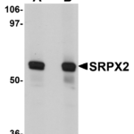 Western blot analysis of SRPX2 in human lung tissue lysate with SRPX2 antibody at (A) 1 and (B) 2 μg/mL.
