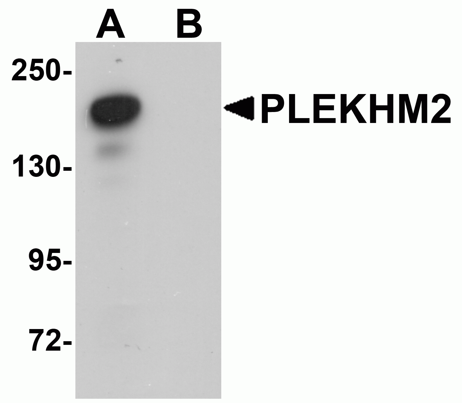 PLEKHM2 Antibody
