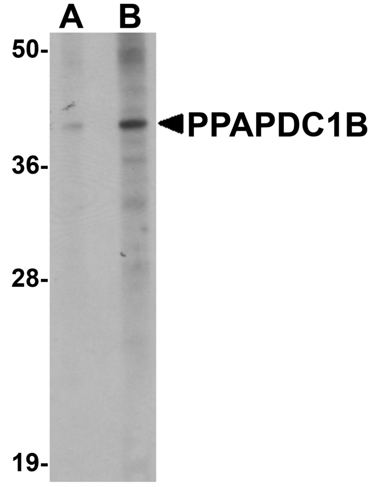 PPAPDC1B Antibody