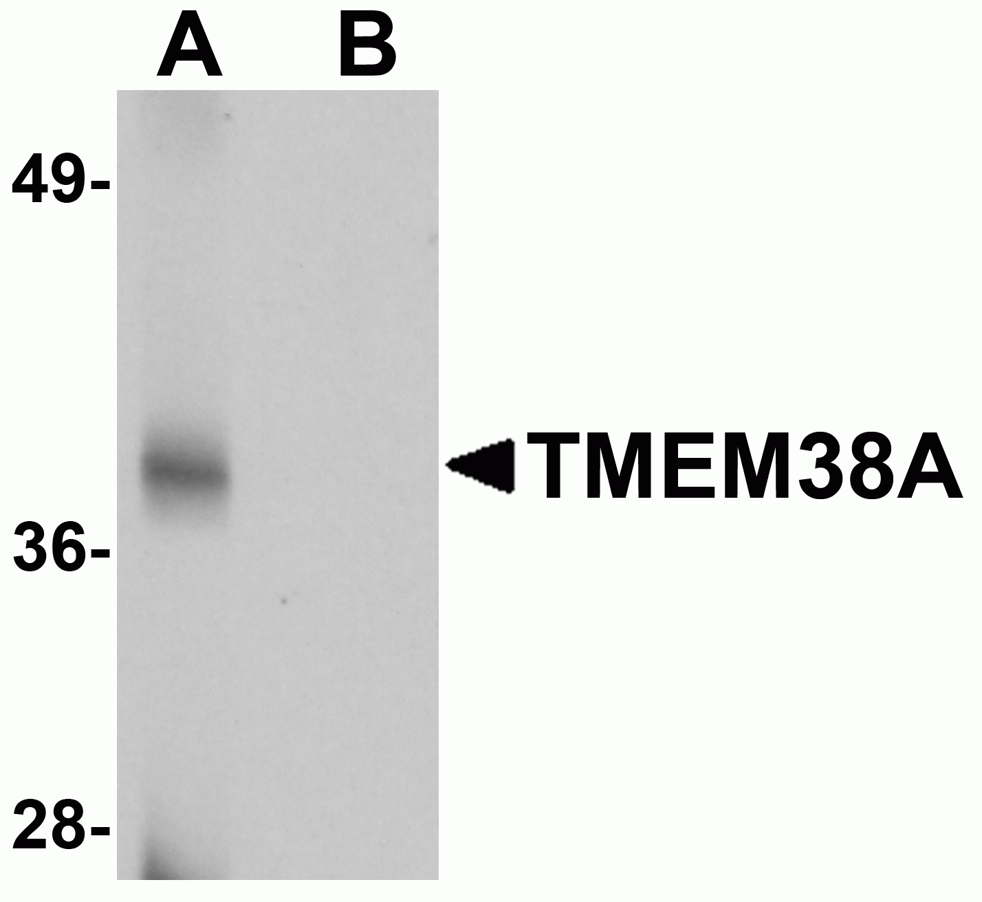 TMEM38A Antibody